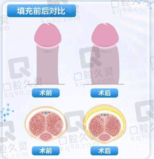 昆山玥美整形医院与其他整形医院相比有什么优势？
