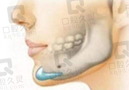 到昆山玥美就诊的流程是怎样的？