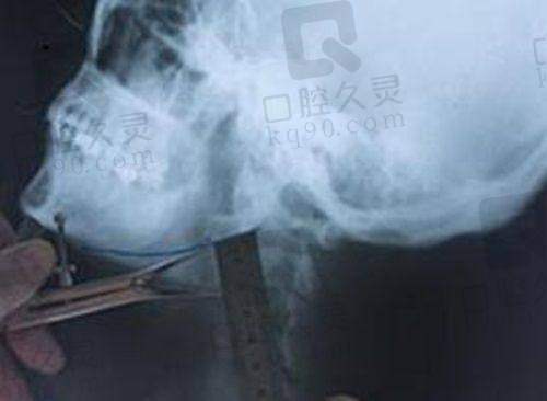 三、石家庄爱眼医院整形科诊疗项目有哪些？