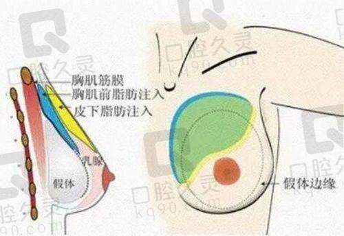 北京煤医周云超取异物技术特色明显
