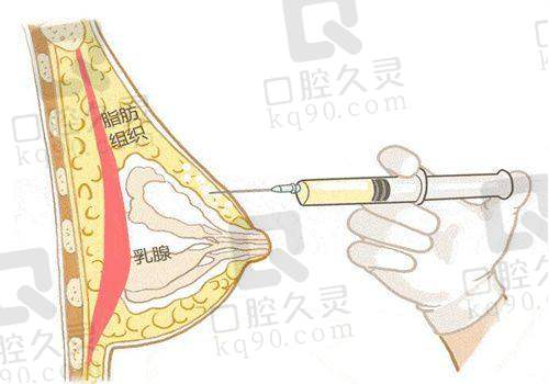 天津爱丽诺整形医院双眼皮手术技术与医生水平