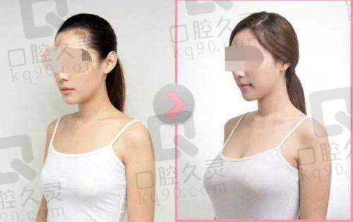 杭州美莱医疗美容医院黄剑媚医生简介:30 年经验、胸部整形专长及技术优势揭秘