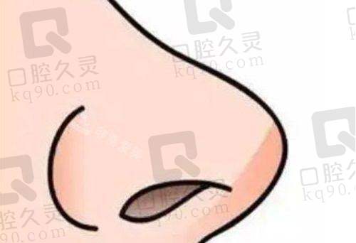 深圳刘冰隆鼻价格3 - 6万元起,技术精湛审美在线,多种隆鼻项目任你选!