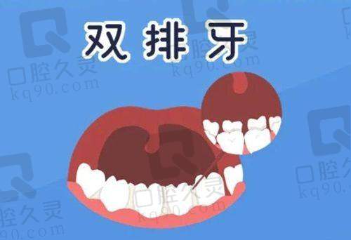 2025贺州人民医院口腔科价格表新鲜出炉，牙齿矫正8000+拔牙380+种植牙8000+洗牙200+