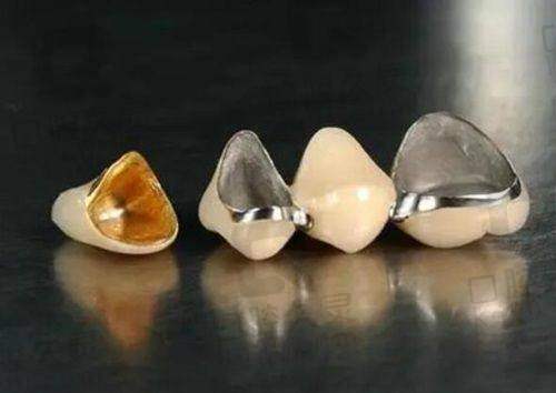 兰溪华博仕口腔的收费情况
