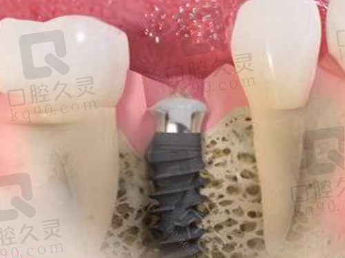一、广州雅度口腔，专精值得信赖的连锁医疗机构