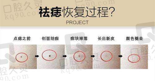 九、石家庄爱眼医院整形科真实的患者评价