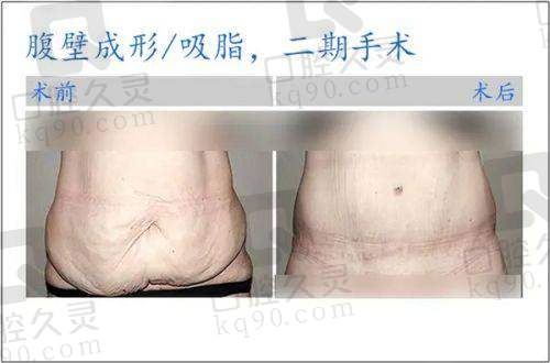 热拉提项目体验如何？