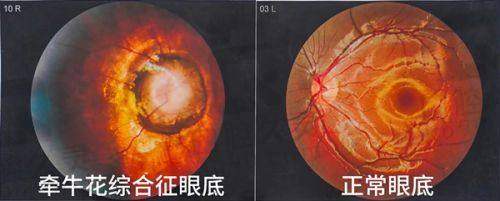 河南省立眼科医院附近宾馆有哪些？怎么预约挂号？多种方式助你轻松就诊挂专家号