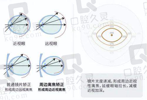 疑惑嘉兴爱尔眼科医院配镜价格贵不贵？技术如何？亲身体验告诉你值不值！