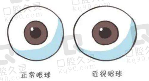 广西2025白内障手术免费政策的具体内容