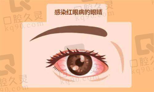 武汉普瑞眼科紧张又期待的手术过程