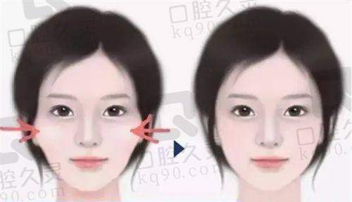 西 京医院微整形医生风采