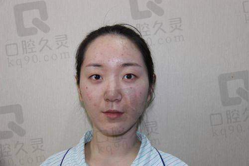 三、白继平医生手术真实实例