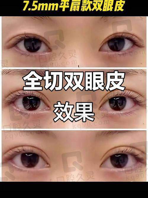 两位医生技术风格对比
