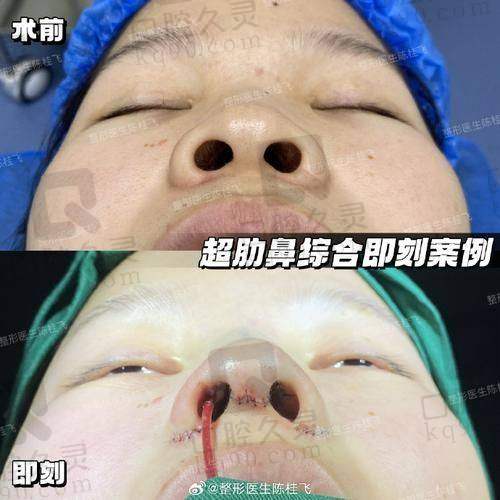 手术前的准备工作有哪些？