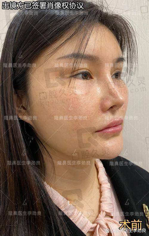 四、王双余医生主推项目——多米诺生态鼻综合