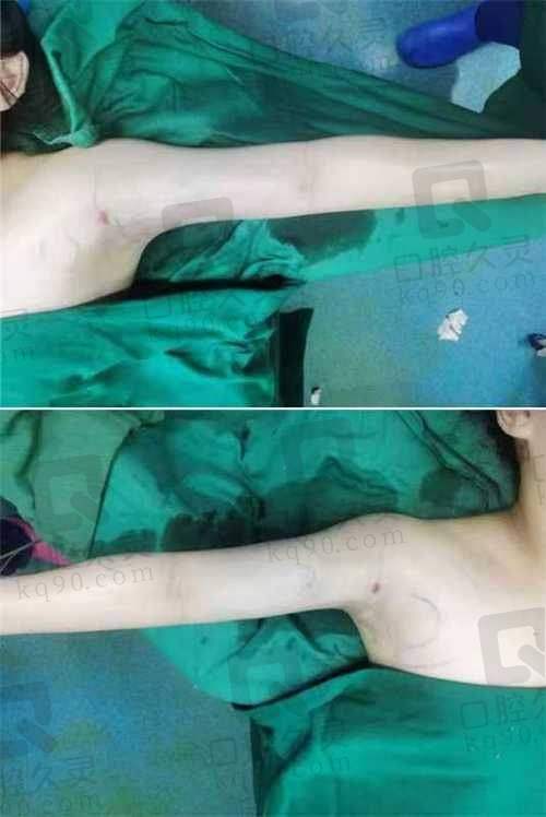 重庆罗海军吸脂好吗？经验丰富技术精细，还能打造马甲线，众多患者满意！ 