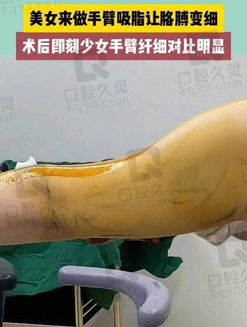 三、重庆罗海军成功实例展示