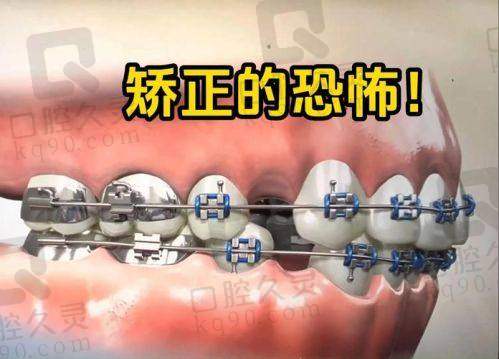 成年以后千万别整牙的真相
