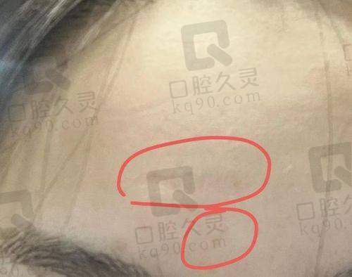 如何判断成都去疤痕正规医院排名的真实性？
