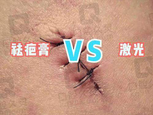 成都去疤痕正规医院的治疗费用与排名有关吗？