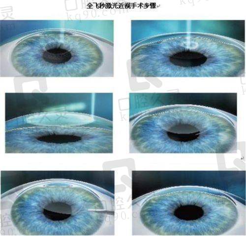 团队与设备：高性价比背后的技术保护