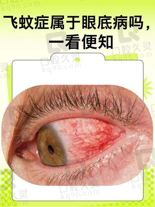 北京同仁眼科王红医生简介