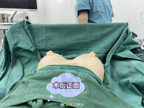内窥镜结合双平面技术的魅力