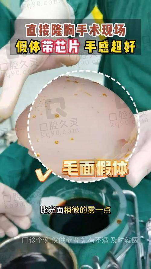 上海悦目佳容吕京陵医生的真实的患者评价如下：