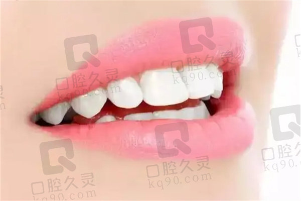 郑州植得口腔医院儿童后牙区预成冠580元起，多项目护航孩子口腔健康乐无忧