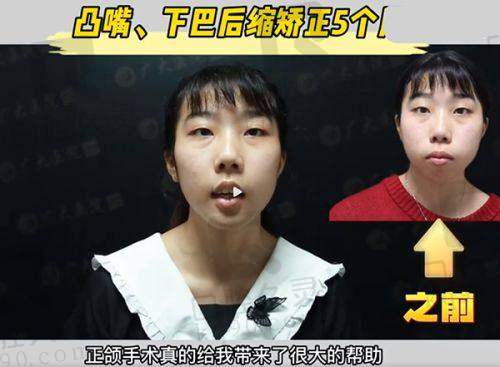 合肥蝶之星医疗美容门诊部靠谱吗？医生经验丰富、服务正规获批，术后满意度高
