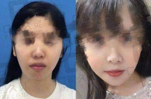 绵阳东美奥拉克医疗美容医院靠谱吗？设备优、项目多，卢元刚黄国强医生技术好