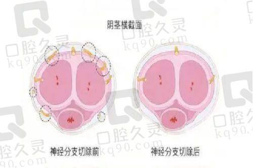 专精医生之张勇