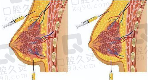 热门项目