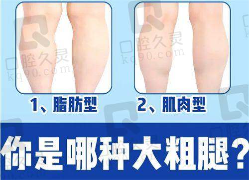 设备引进