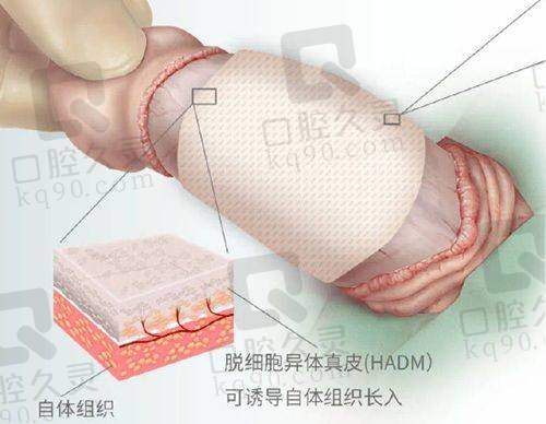 北京贵美汇医院靠谱吗？假体隆胸、吸脂、私密抗衰等项目多，收费合理效果好