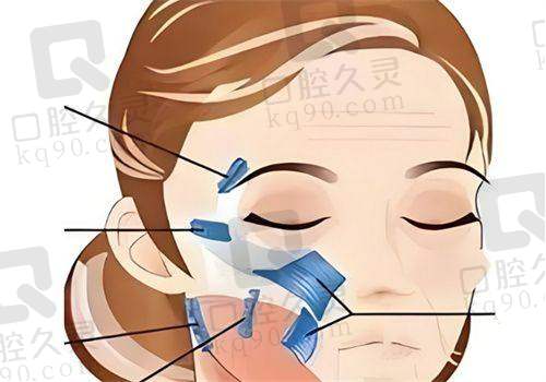 北京穆宝安可以做面部提升手术，专业技术打造紧致面容，效果显著受认可 