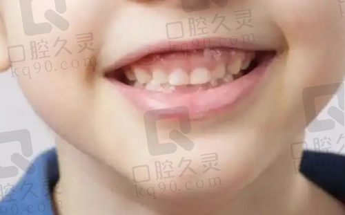 南京卡瓦口腔医院怎么样，正规资质、雄厚医资与实惠种植牙价格揭秘