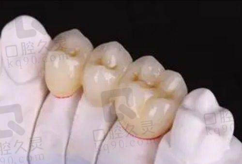 瑞泰口腔服务体验如何？就医像进了星级诊所