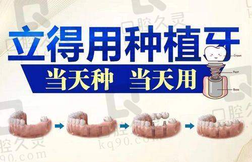 三、银川诺贝尔口腔医院口碑评价之服务态度