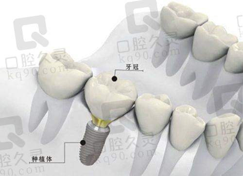 真实用户口碑实例