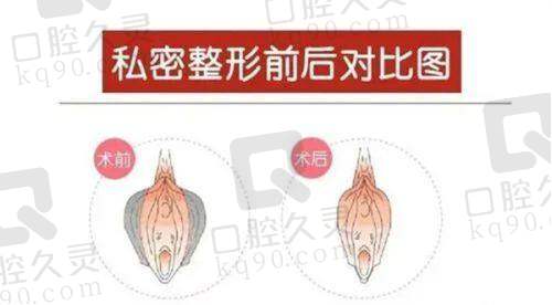 手术过程，安心又舒适