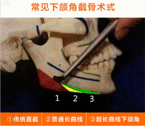 三、苏州问兰医疗美容门诊部医生介绍: