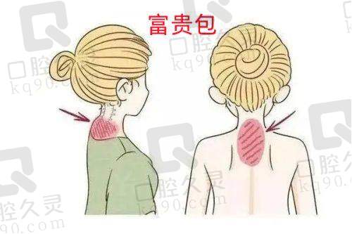 翁晓娟医生介绍