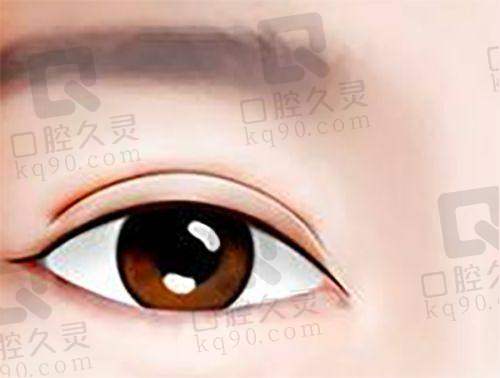 阳泉美亚丁鹏医生（双眼皮、眼袋）怎么样？