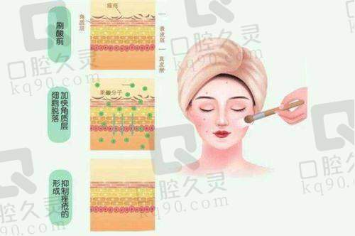 技术方面