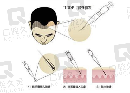 头顶加密的价格是如何确定的？