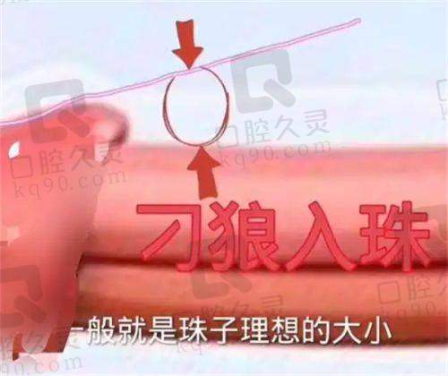 医院预约挂号方式