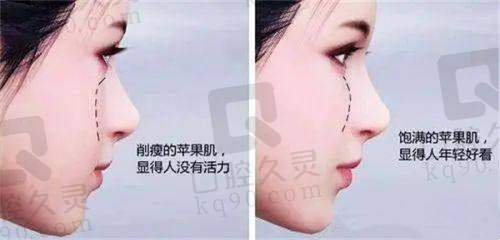 热门项目表现